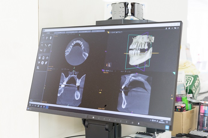 あさかハートフル歯科｜コンピューターソフト